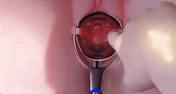 【3D动画无修】iwara Lumii 爱弥斯Aemeath 子宫观察【1V】